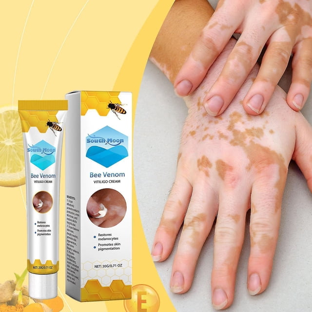 Crema para el tratamiento del vitíligo con veneno de abeja, crema para el vitíligo con veneno de abeja, mejora la pigmentación de la piel y reduce las manchas blancas