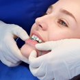 thumbnail image 3 of RV Tira de pulido dental - 60 piezas/paquete de tiras abrasivas dentales Tira abrasiva dental Pulido de dientes Acabado de dientes Kit de herramientas de contorno brillante, 3 of 5