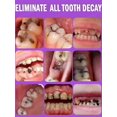 thumbnail image 4 of Reparación de caries dentales, reparación de todas las cavidades, 4 of 4