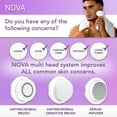 Spa Sciences NOVA Sonic Facial Cleansing and Exfoliating Device with