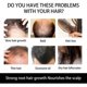 thumbnail image 2 of JAYSUING Hair Growth Roller Safe Painless Titanium Microneedle Roller Strong Root Nourish Scalp | |, 2 of 4