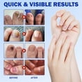 thumbnail image 5 of Fungal Nail Patches, Fungal Nail Treatment 21Pcs, Nails Repair Patches,Nails Fungus Treatment for Toenail,ToeNail Fungal Treatment for Toenails Extra, 5 of 5