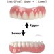 thumbnail image 5 of Upper And Lower Veneer Dentures For Women And Men Fake Teeth Natural Shade! Fix Your Smile At Home Within Minutes!, 5 of 5