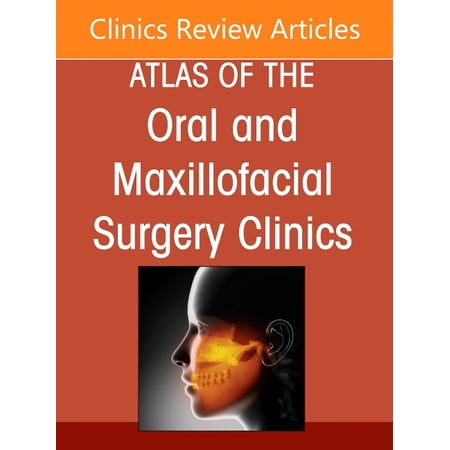 Clinics: Dentistry Temporomandibular Joint Surgery, an Issue of Atlas of the Oral & Maxillofacial Surgery Clinics: Volume 34-2, Book 34, (Hardcover)