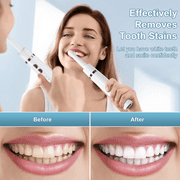 NEXPURE Tooth Polisher, Teeth Whitening Kit with 1500mAh Battery, Plaque Remover for Teeth with 5 Brush Heads & Speeds Modes, Ipx6 Waterproof, White