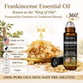 thumbnail image 3 of Frankincense Roll On – Pre-Diluted Frankincense Oil Essential Oil for Skin Care, Aromatherapy Roller, Frankincense Roller Ball, 3 of 5