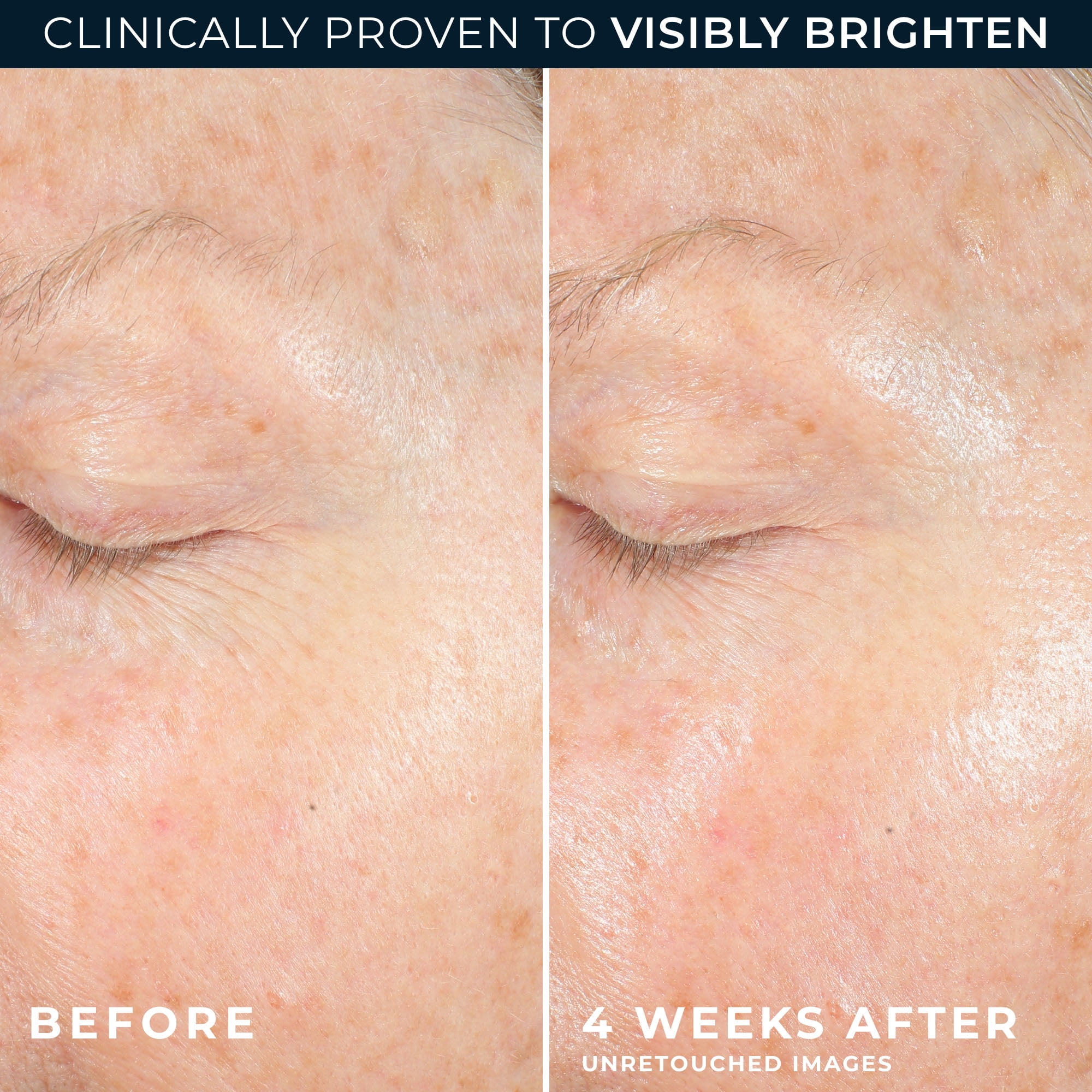 RoC Multi Correxion Brightening Anti-Aging Gel Moisturizer with Vitamin C, for Dark Spots & Uneven Tone, 1.7 oz