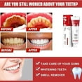 thumbnail image 4 of LAICAIW Yayashi Sp-4 Probiotic Whitening Toothpaste, Sp-4 Ultra Whitening Toothpaste, Yayashi Sp-4 Toothpaste Fresh Breath Toothpaste, Ultra SP-4 Probiotic Whitening Toothpaste, Probiotic Toothpaste, 4 of 7