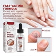thumbnail image 2 of Anti-Fungal Soothing Oil Foot Care Inner Nail Repair Essence Pedicure Nails Whitening Onychomycosis Relief Oil, 2 of 5