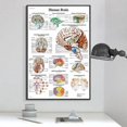 thumbnail image 3 of Anatomical illustration of the human brain poster, canvas, large size. For classrooms, clinics, hospitals, doctors' offices, 3 of 4