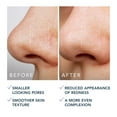 thumbnail image 7 of FOREO KIWI Pore Minimizing Toner Pads with Witch Hazel and Cica, Dual-Sided Exfoliating Facial Pads, 60 Count, 7 of 7