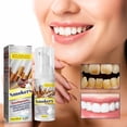 thumbnail image 3 of Pasta dental blanqueadora, pasta dental para fumadores, gel blanqueador para eliminar manchas de fumadores, crema limpiadora para un aliento fresco y sin olor (60 ml), 3 of 5