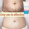 thumbnail image 3 of Anti Stretch Mark Lifting Cream Scar Repair 60g, 3 of 8