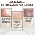 thumbnail image 4 of Líquido con ácido lactobiónico, exfoliante suave, limpieza profunda, puntos negros -4100715360034, 4 of 5