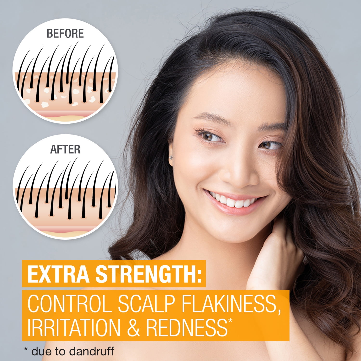 Buy Neutrogena Scalp Therapy AntiDandruff Extra Strength Shampoo 12 fl