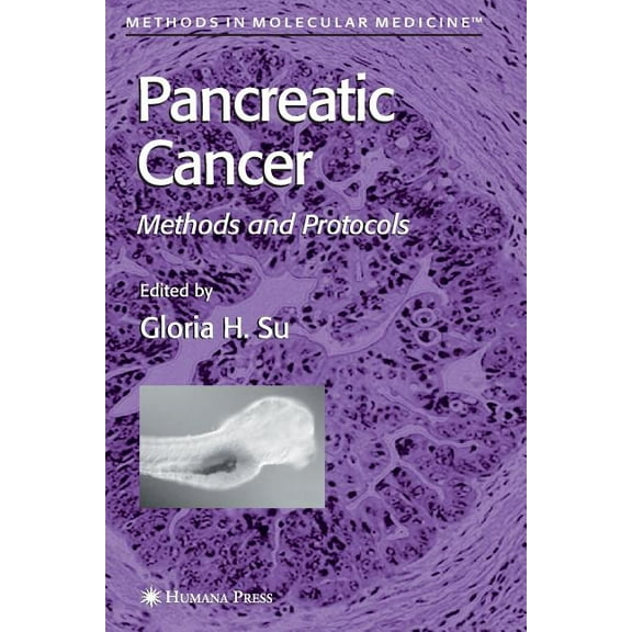 Methods in Molecular Medicine Pancreatic Cancer: Methods and Protocols, Book 103, (Paperback)