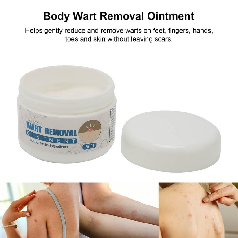 eelhoe-wart-remover-ointment-side-effects-isoftbytes