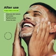 thumbnail image 5 of Piel del Sol Acne Foaming Wash Cleanser Benzoyl Peroxide Acne Treatment Fragrance-Free, 8.4 Fl Oz (Pack of 1), 5 of 7