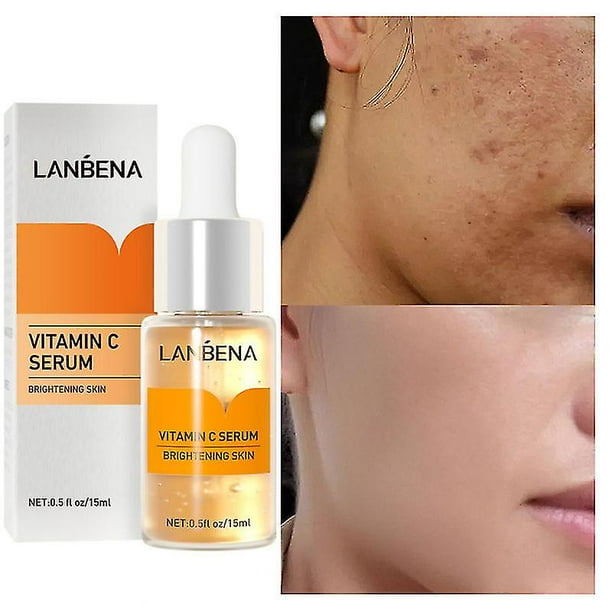 Suero para blanquear la cara con vitamina C, 3 uds., aclara las manchas, aclara la esencia de la piel del rostro, elimina las manchas oscuras, elimina las pecas y el cuidado de las manchas