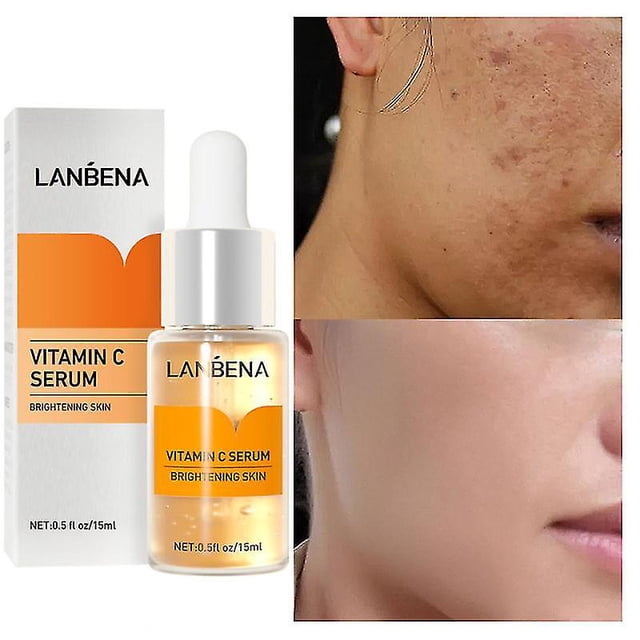 Belita Amy, suero facial blanqueador con vitamina C, aclara las manchas, aclara la esencia de la piel Facial, destiñe las manchas oscuras, elimina las pecas y el cuidado de las manchas kaili Sencillez