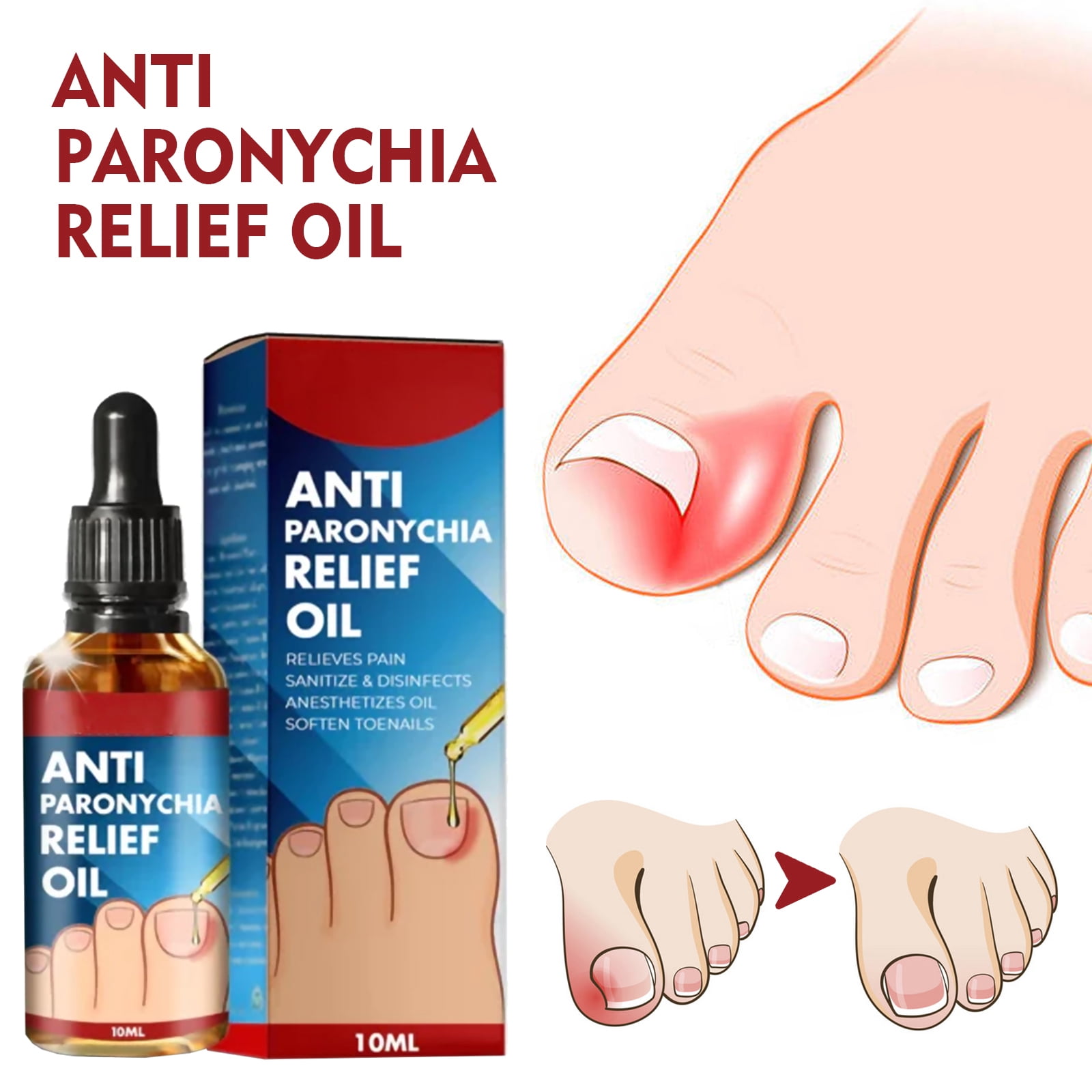 Alvantor Ingrown Toenail Treatment, Pain Relief and Nail Care for Ingrown Corrector and Fungus Treatment, 0.34fl.oz
