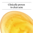 thumbnail image 3 of Neutrogena Oil-Free Acne Face Wash, Salicylic Acid Facial Cleanser & Acne Treatment, 9.1 fl oz, 3 of 8