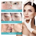 thumbnail image 2 of Suero de Niacinamida con Niacinamida Retinol Ácido Hialurónico y Ácido Salicílico kaili Sencillez, 2 of 5