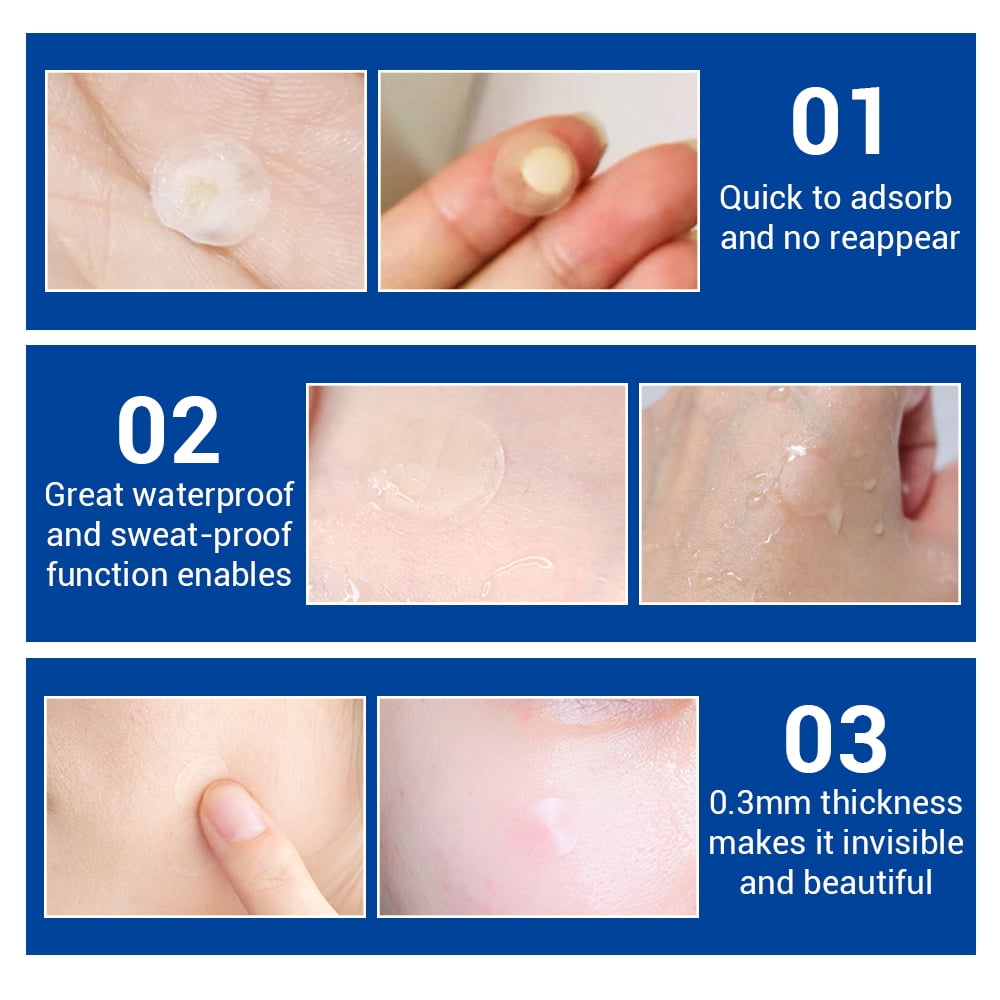 acne pimple patch lanbena