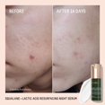 thumbnail image 2 of Sérum de noche BIOSSANCE Squalane + Ácido láctico 30 ml, 2 of 7