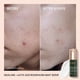 thumbnail image 2 of Sérum de noche BIOSSANCE Squalane + Ácido láctico 30 ml, 2 of 7
