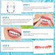 thumbnail image 4 of Carillas dentales, dentaduras postizas blancas para mandíbula superior e inferior, dientes falsos para mujeres y hombres, cómodo Flex Cosme, 4 of 5