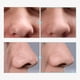 thumbnail image 4 of Sérum reafirmante de poros TOSOWOONG de 30 ml con niacinamida y alantoína, 4 of 6