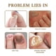 thumbnail image 3 of Toenail Renewal Solution Extra Strength Care for Toe Nail & Fingernails, Nail Repair Solution for Thick, broken, Discolored Nails 3ml, 3 of 5