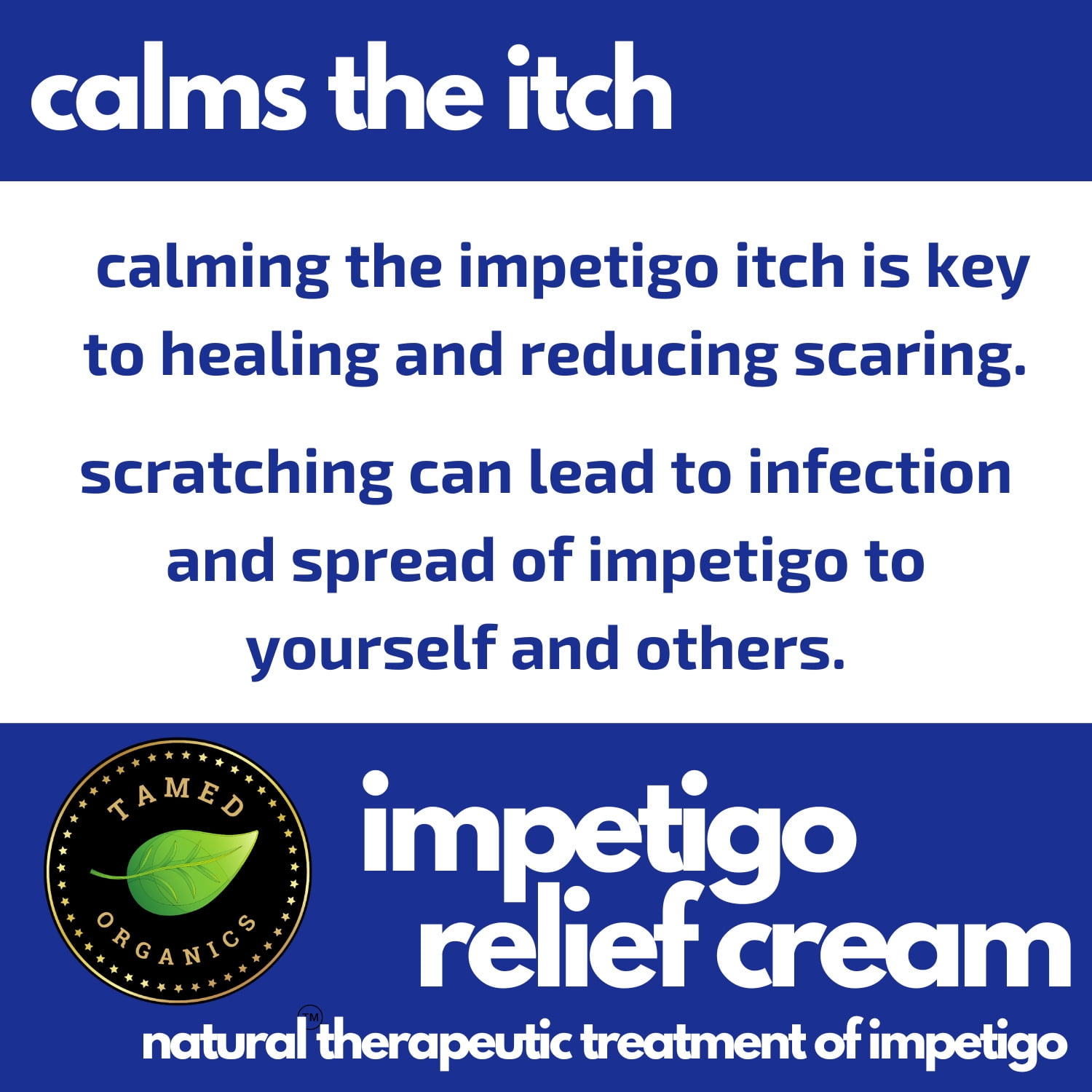 Impetigo Natural Topical Relief Treatment  Cream Over The Counter by Tamed Organics Brand
