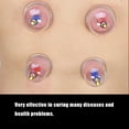 thumbnail image 4 of Massage Cupping Set,24pcs U shape Cups Cupping Set Cupping Suction Set Time-Tested Durability, 4 of 8
