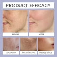 thumbnail image 6 of Herunwer Dark Spot Corrector for Face and Body, Sun Spot Corrector, Age Spot Remover For Face, Inner Thighs, Hands, Intimate Areas, Dark Spot Remover, 6 of 9