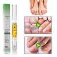 thumbnail image 2 of Líquido para uñas grises de manos y pies. Líquido para uñas grises. Líquido espesante y nutritivo para uñas grises, 5 ml, 2 of 8