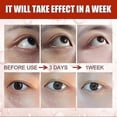 thumbnail image 4 of Suero esencial para ojos Yuxing 30 ml Antipartículas Hinchazón Elimina grasa, 4 of 4