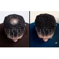 thumbnail image 4 of 10 Lociones para Tratamiento de Calvicie JYE Natural, 4 of 5