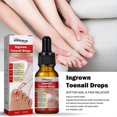 thumbnail image 5 of Barsinfi 30ML Ingrown Toenail Treatment,nail Growth Treatment,ingrown Toenail Drops Cuticle Nail Oil Ingrown Toenail Correction, 5 of 5