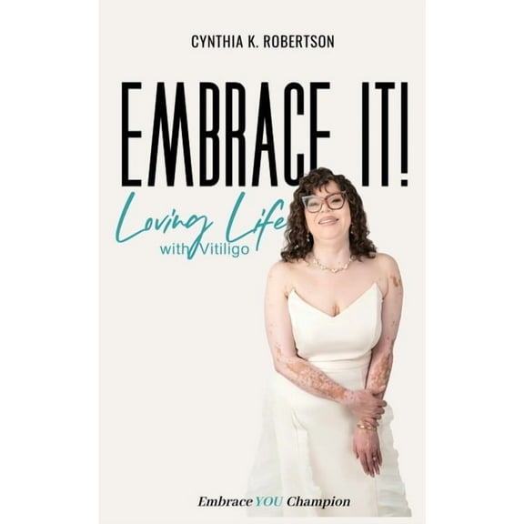 Embrace It: Loving Life with Vitiligo, (Paperback)