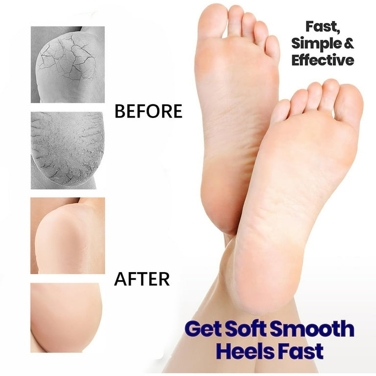 Moisturizing Gel Heel Socks for Cracked Heels Open Toe Spa Socks