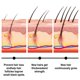 thumbnail image 3 of JAYSUING Batanam Hair Oil for Hair Growth 30ml Hair Loss Treatment, Promotes Hair Thickness, 3 of 5