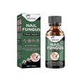 thumbnail image 1 of EELHOE 30ml Nail Fungus Treatment Solution Extracts Remove Onychomycosis No Yellowing Restore Shine, 1 of 5