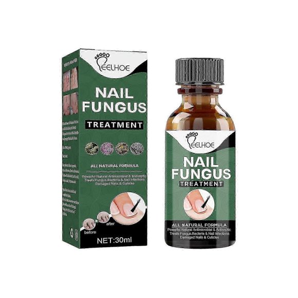 EELHOE 30ml Nail Fungus Treatment Solution Extracts Remove Onychomycosis No Yellowing Restore Shine