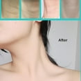 thumbnail image 2 of Silicone Patches Face Tape 1.6 x 59inch, For Burn, Scars, Surgical Scars, C-Section, Overnight Beauty Tape, Hydrated Skin, Cut To Fit, Reusable, 2 of 5