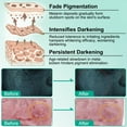 thumbnail image 6 of ikzee Dark Spot Cream for Radiant Skin, with Hyaluronic Acid, Vitamin B5, C, E, Retinol and Nicotinamide 50ml/1.7floz, 6 of 10