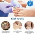 thumbnail image 7 of Corrector Patches for Ingrown Toenail Treatment, Professional Toe Nail Treatment with Elastic Fabric, Non-Woven Fabric for Breathable Nail Groove Relief, 7 of 7