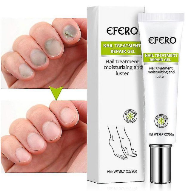Gel reparador de uñas, tratamiento de hongos en las uñas de los pies, restaura las uñas amarillas quebradizas para uñas dañadas