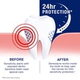 thumbnail image 2 of Sensodyne Full Protection Plus Whitening Toothpaste 4 oz Each, 2 of 7